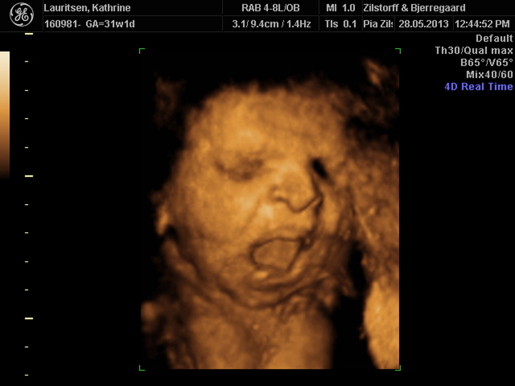 Scanning 04. 3D!