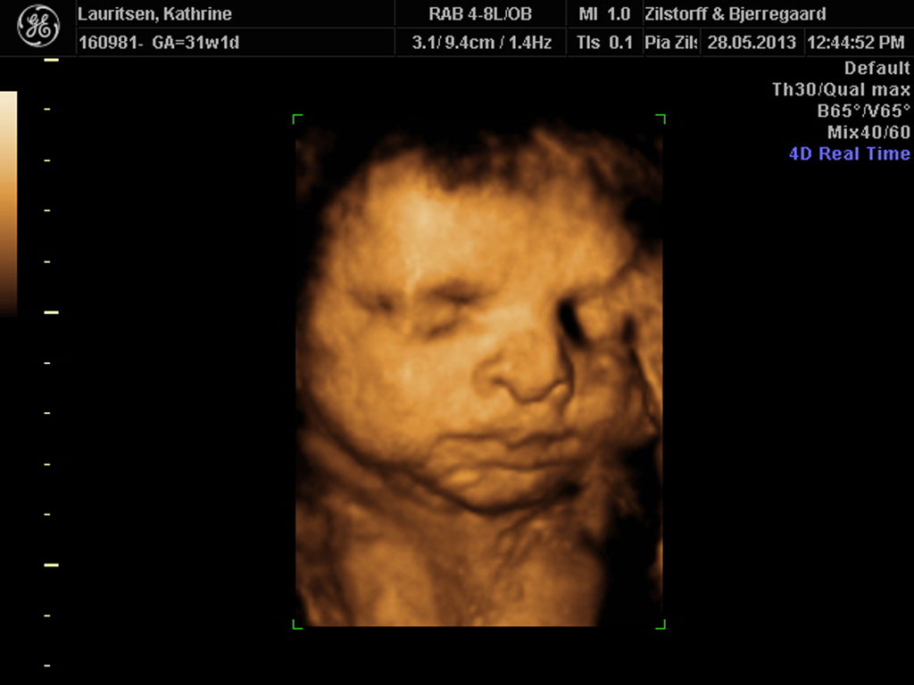 Scanning 04. 3D!